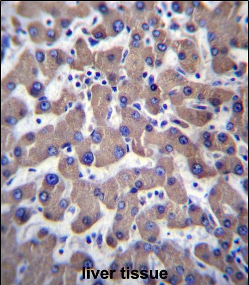 14 - TMM70 Antibody (C-term) AP13011b