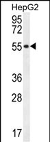 1 - UXS1 Antibody (C-term) AP13077B