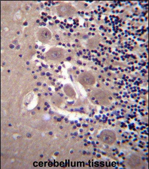 14 - NPTXR Antibody (Center) AP13143c