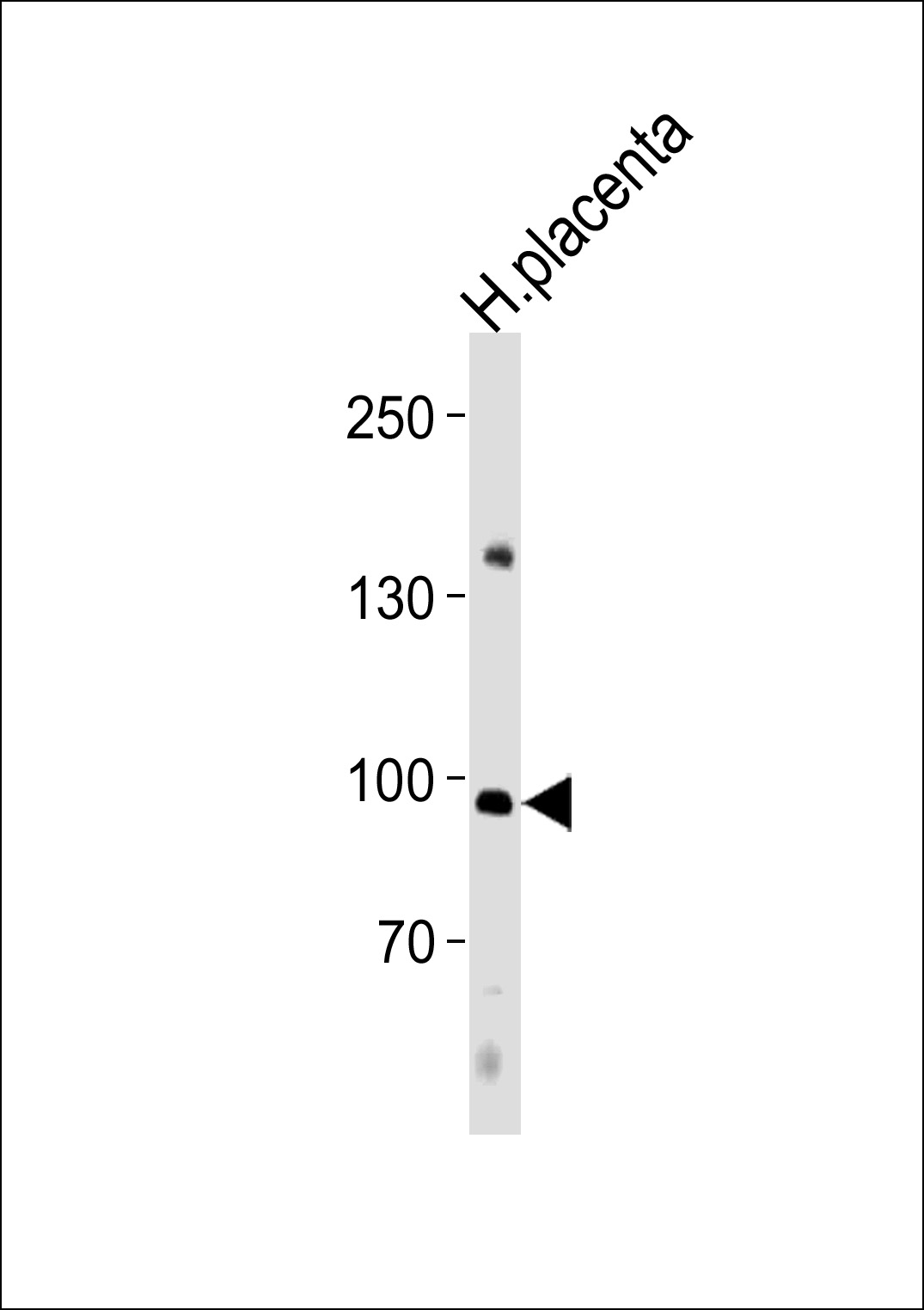1 - NFATC4 Antibody (C-term) AP13162b