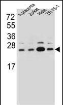 1 - SSR2 Antibody (C-term) AP13170b