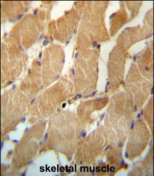 14 - NDUFAF2 Antibody (Center) AP13341c