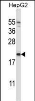 1 - NDUFAF2 Antibody (Center) AP13341c