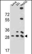1 - PGAM4 Antibody (N-term) AP13349a