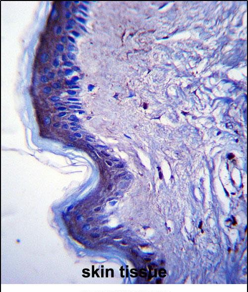 14 - RHBDF2 Antibody (N-term) AP13588A