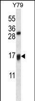 1 - VKORC1L1 Antibody (N-term) AP13669a