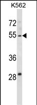 1 - HYAL4 Antibody (Center) AP13683C