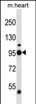 1 - PYGB Antibody (N-term) AP13699a