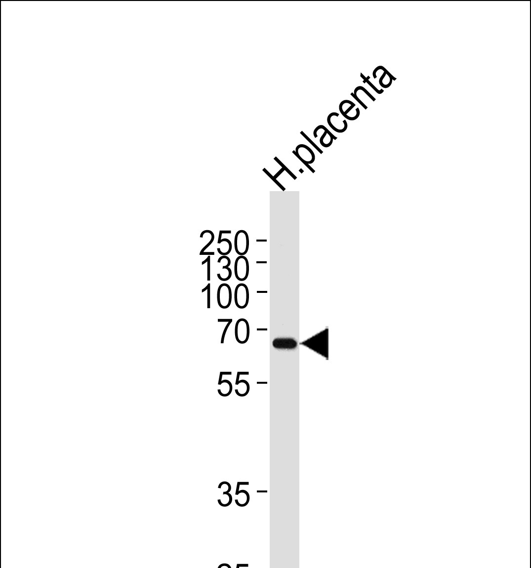 1 - MMP19 Antibody (N-term) AP13759a