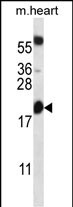 1 - BCL2 Antibody (Center) AP13823c