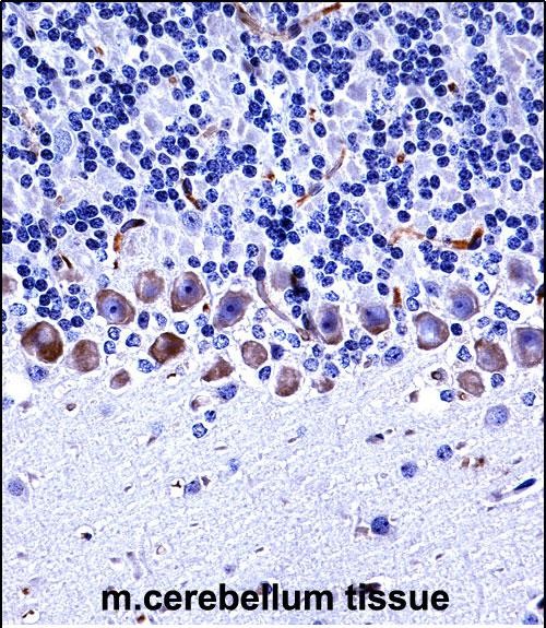 14 - Mouse Epha4 Antibody (Center) AP13915c