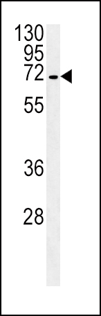 1 - SLC22A1 Antibody (C-term) AP13944b
