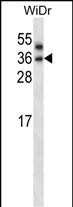 1 - PNPLA4 Antibody (C-term) AP13971b