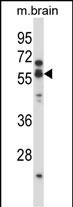 1 - CHRNA5 Antibody (Center) AP14006c