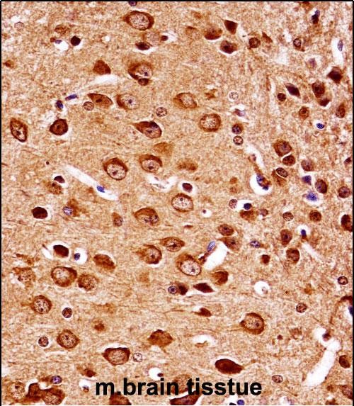 14 - Mouse Map2k7 Antibody (Center) AP14155c