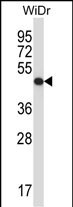 1 - UQCRC2 Antibody (Center) AP14382c