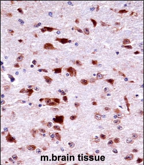 14 - Mouse Phkg2 Antibody (N-term) AP14454a