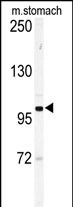 1 - Eph Receptor A6 Antibody (C-term) AP7611b