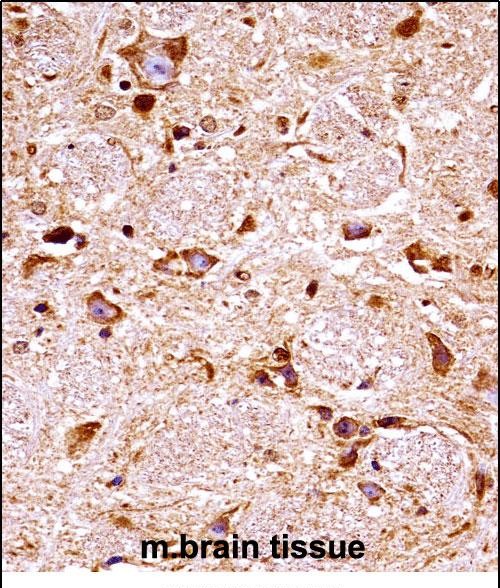 14 - Mouse Fgfr3 Antibody (Center) AP14841c