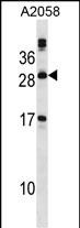 1 - PLA2G12A Antibody (Center) AP16639c