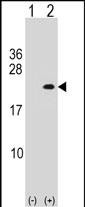 1 - PLA2G12A Antibody (Center) AP16639c