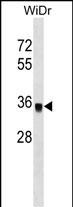 1 - PPP1CC Antibody (C-term) AP16979b