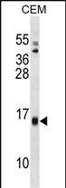 1 - SAA4 Antibody (C-term) AP17058b
