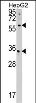 1 - CDS2 Antibody (Center) AP17134c
