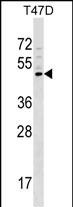 1 - GCNT1 Antibody (Center) AP17151c