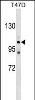 1 - ATP2C1 Antibody (C-term) AP17155b