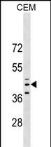 1 - QPCT Antibody (C-term) AP17434b