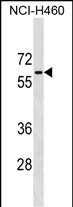 1 - PGM5 Antibody (C-term) AP17589b