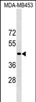 1 - OR1N2 Antibody (N-term) AP17637a