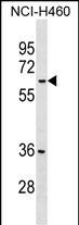 1 - MDH1B Antibody (Center) AP17695c