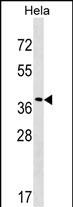 1 - VPS37C Antibody (Center) AP17716c