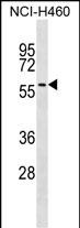 1 - UGT2A3 Antibody (Center) AP17728c
