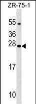 1 - NXNL1 Antibody (Center) AP17740c