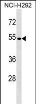 1 - ATP6V1C2 Antibody (Center) AP17823c