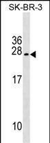 1 - TUSC5 Antibody (Center) AP17939c