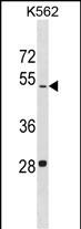 1 - LDHAL6B Antibody (N-term) AP18503a