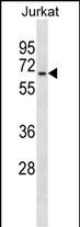 1 - GALNT14 Antibody (N-term) AP18637a