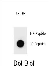 6 - Phospho-PARP1(S41) Antibody AP3786d