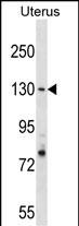1 - RFC1 Antibody (N-term) AP19110a