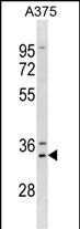 1 - MSX1 Antibody (Center) AP19261C