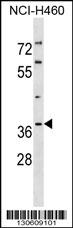 1 - PIG3 Antibody (C-term) AP19269b