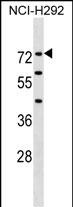 1 - F12 Antibody (N-term) AP19282a