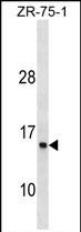 1 - ATP6V1G1 Antibody(C-term) AP19555b