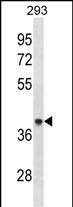 1 - ACAA1 Antibody (Center) AP19909c
