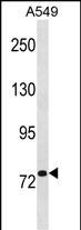 1 - RRM1 Antibody (N-term) AP20081a