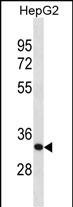 1 - SFXN1 Antibody (C-term) AP20281b